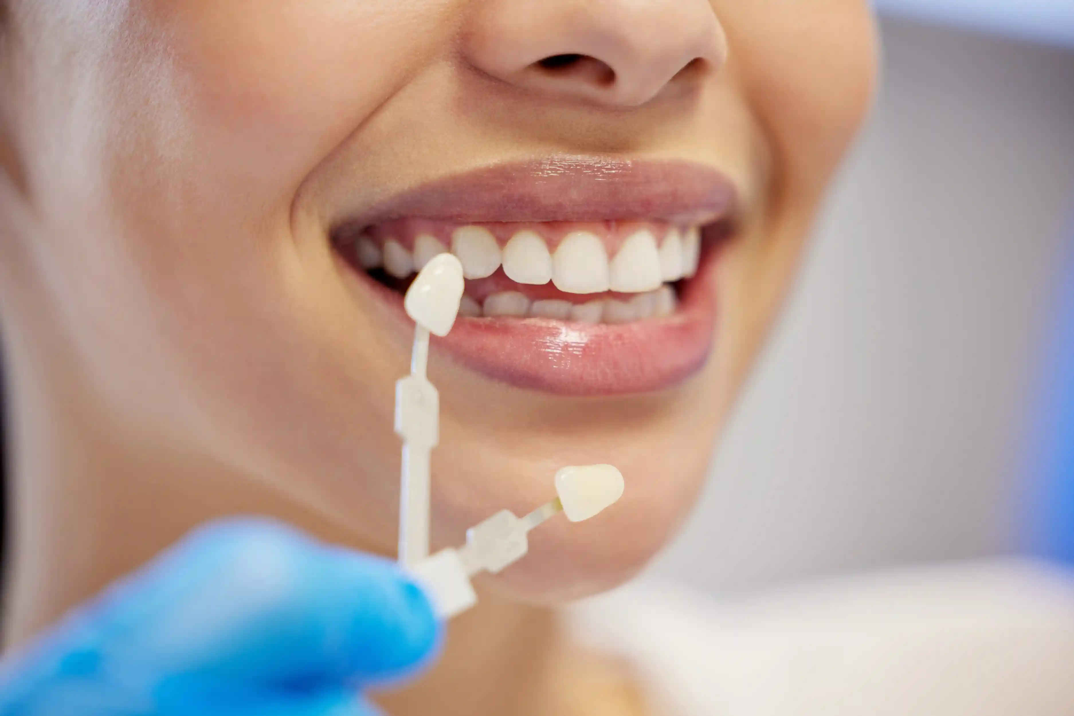 Improve the Details That Shape Your Smile